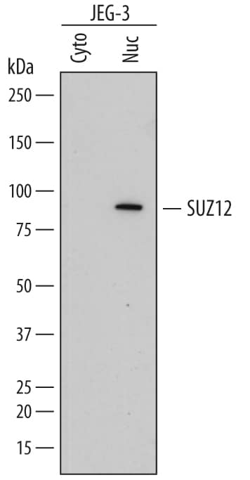 Detection of Human SUZ12 antibody by Western Blot.