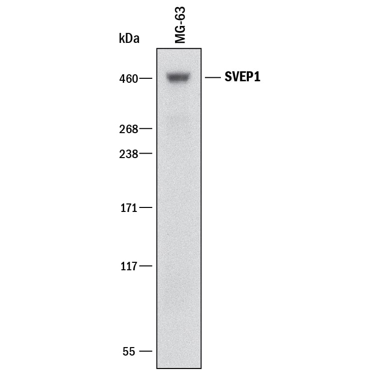 Detection of Human SVEP1 antibody by Western Blot.