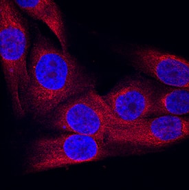 SVEP1 antibody in MG-63 Human Cell Line by Immunocytochemistry (ICC).