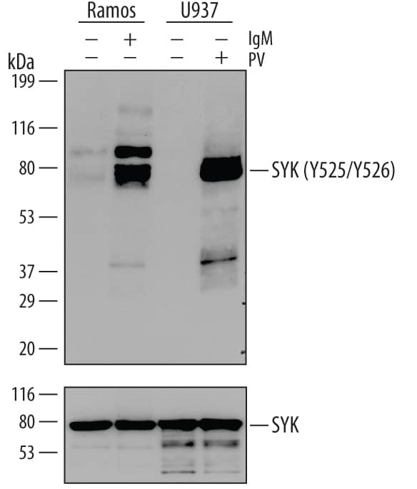 Detection of Human Phospho-SYK (Y525/Y526) antibody by Western Blot.