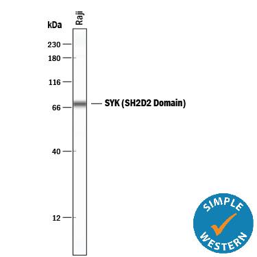 Detection of Raji human Burkitt's lymphoma cell line 0.2 antibody by Simple WesternTM.