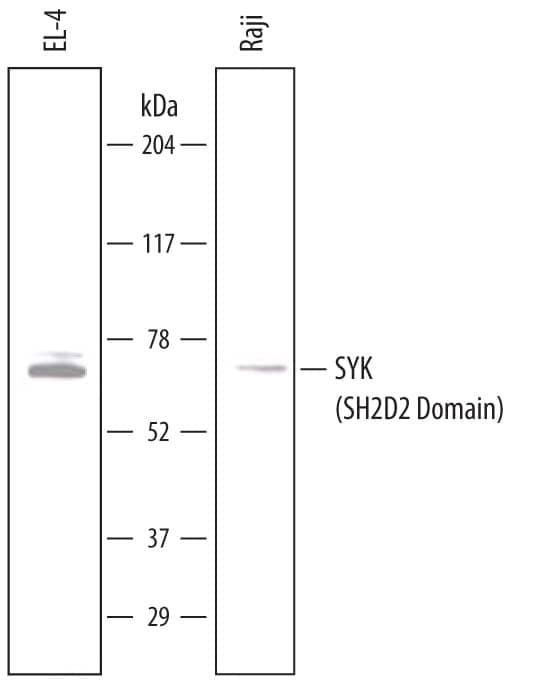 Detection of Human and Mouse SYK (SH2D2 Domain) antibody by Western Blot.