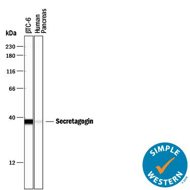 Detection of Human and Mouse Secretagogin antibody by Simple WesternTM.