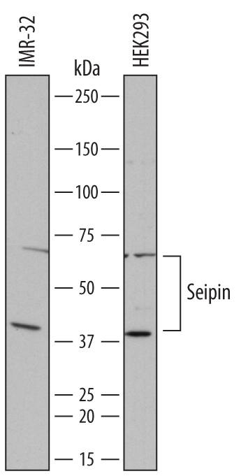 Detection of Human Seipin/BSCL2 antibody by Western Blot.