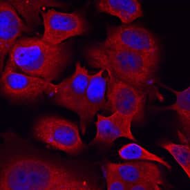 Semaphorin 3C antibody in MCF-7 Human Cell Line by Immunocytochemistry (ICC).