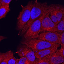 Semaphorin 3C antibody in MCF-7 Human Cell Line by Immunocytochemistry (ICC).