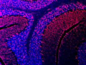 Semaphorin 3E antibody in Mouse Brain by Immunohistochemistry (IHC-Fr).