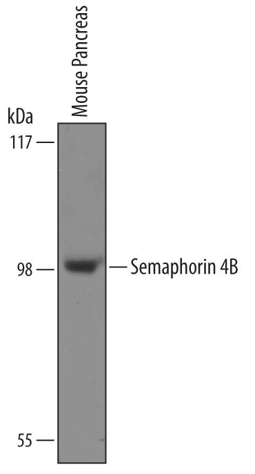 Detection of Mouse Semaphorin 4B antibody by Western Blot.