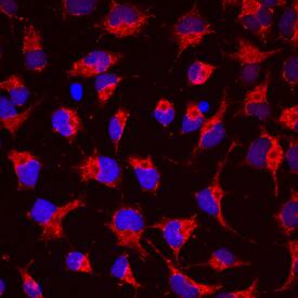 Semaphorin 4C antibody in Rat Cortical Stem Cells by Immunocytochemistry (ICC).