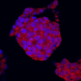 Semaphorin 5A antibody in  betaTC-6 Mouse Cell Line by Immunocytochemistry (ICC).