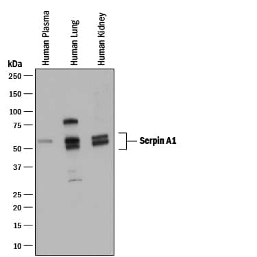 Detection of Human Serpin A1/a1-Antitrypsin antibody by Western Blot.