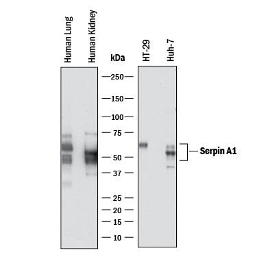 Detection of Human Serpin A1/ alpha1‑Antitrypsin by Western Blot. Detection of Human Serpin A1/a1-Antitrypsin antibody by Western Blot.