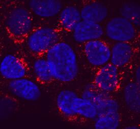 Serpin A1/a1-Antitrypsin antibody in HepG2 Human Cell Line by Immunocytochemistry (ICC).