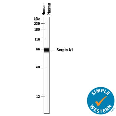Detection of Human Serpin A1/a1-Antitrypsin antibody by Simple WesternTM.