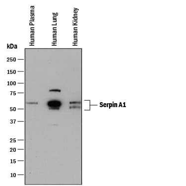 Detection of Human Serpin A1/a1-Antitrypsin antibody by Western Blot.