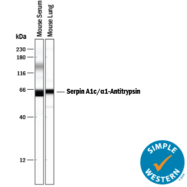 Detection of Mouse Serpin A1c/a1-Antitrypsin antibody by Simple WesternTM.