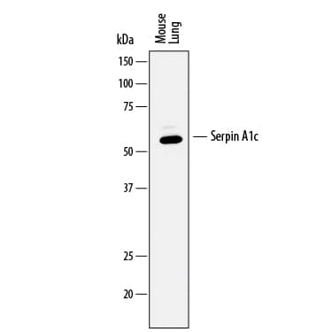 Detection of Mouse Serpin A1c/a1-Antitrypsin antibody by Western Blot.