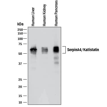 Detection of Human Serpin A4/Kallistatin antibody by Western Blot.