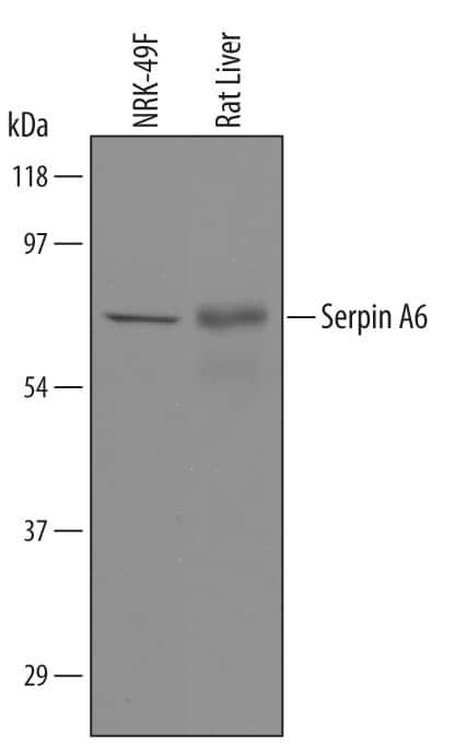 Detection of Rat Serpin A6 antibody by Western Blot.