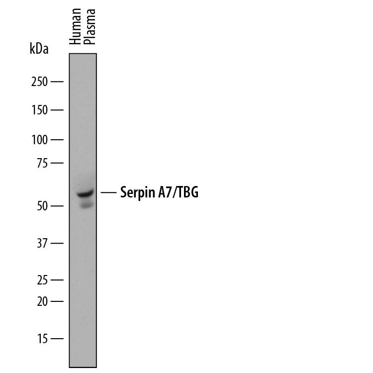 Detection of Human Serpin A7/TBG antibody by Western Blot.