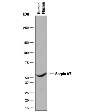 Detection of Human Serpin A7/TBG antibody by Western Blot.