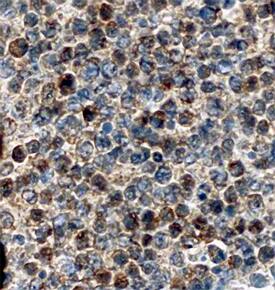 Serpin A9/Centerin antibody in Human Lymphoma by Immunohistochemistry (IHC-P).