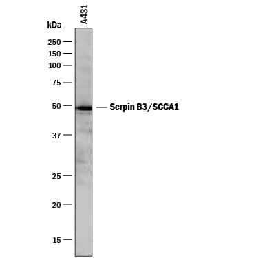 Detection of Human Serpin B3/SCCA1 antibody by Western Blot.