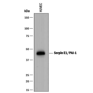 Detection of Human Serpin E1/PAI-1 antibody by Western Blot.