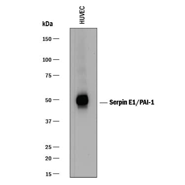 Detection of Human Serpin E1/PAI-1 antibody by Western Blot.