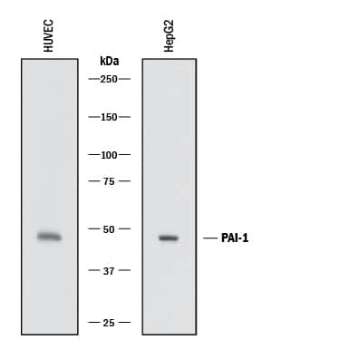 Detection of Human Serpin E1/PAI-1 antibody by Western Blot.