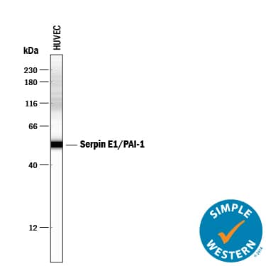 Detection of Human Serpin E1/PAI-1 antibody by Simple WesternTM.