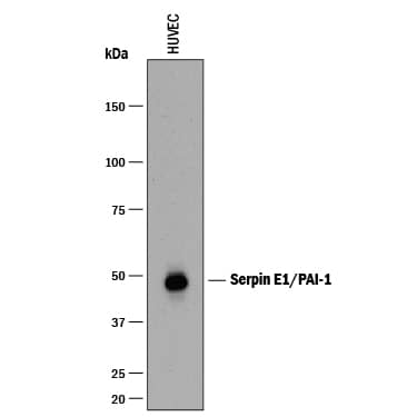 Detection of Human Serpin E1/PAI-1 antibody by Western Blot.