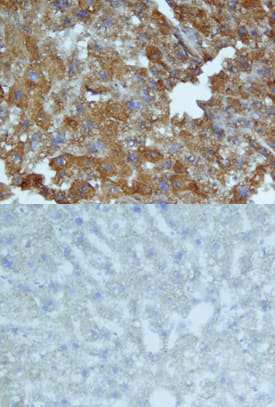 Serum Amyloid A1/A2 antibody in Mouse Liver by Immunohistochemistry (IHC-Fr).