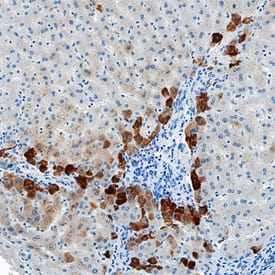 Serum Amyloid A1 antibody in Human Liver by Immunohistochemistry (IHC-P).