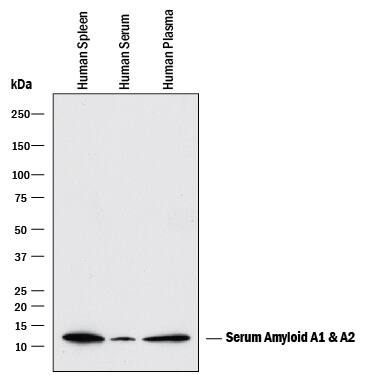 Detection of Human Serum Amyloid A1/A2 antibody by Western Blot.