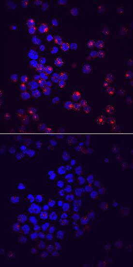 Phospho-Siglec-2/CD22 (Y822) antibody in Raji Human Cell Line by Immunocytochemistry (ICC).