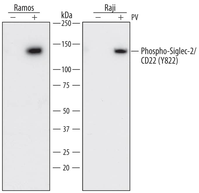 Detection of Human Siglec-2/CD22 antibody by Western Blot.