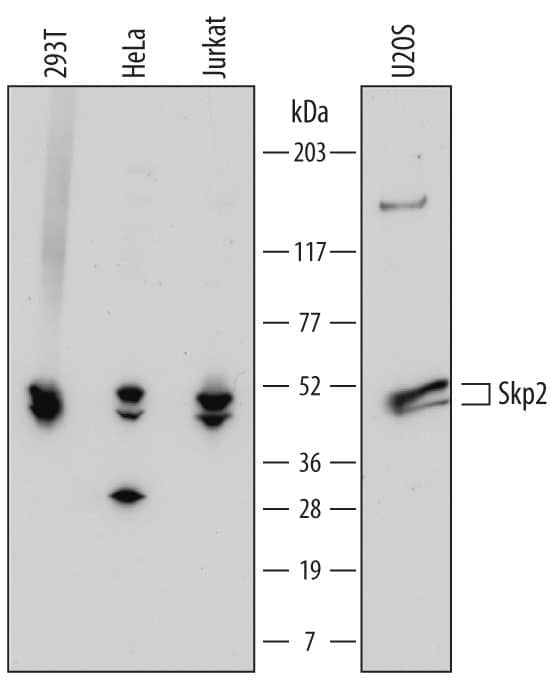 Detection of Human Skp2 antibody by Western Blot.