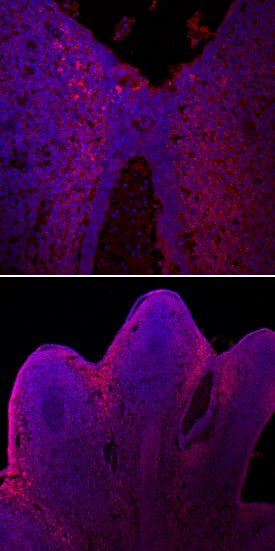 Slit2 antibody in Embryonic Mouse Hindlimb by Immunohistochemistry (IHC-Fr).