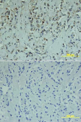 Smad1 antibody in Human Breast by Immunohistochemistry (IHC-P).