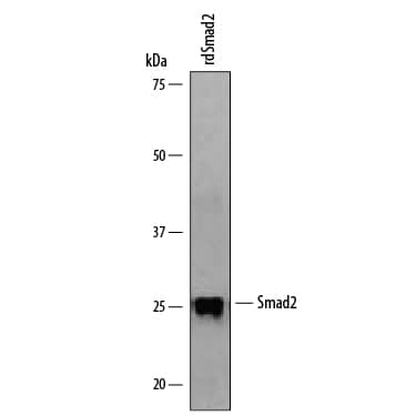 Detection ofDrosophilaSmad2 antibody by Western Blot.