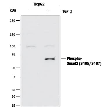 Detection of Human Phospho-Smad2/3 (S465/S467) antibody by Western Blot.