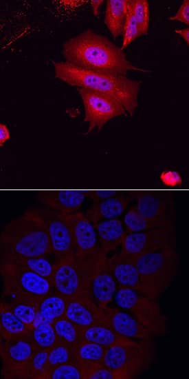 Smad2/3 antibody in MCF-7 Human Cell Line by Immunocytochemistry (ICC).