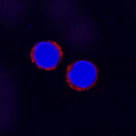 Smad4 antibody in Human PBMCs by Immunocytochemistry (ICC).