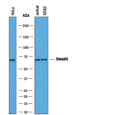 Detection of Human Smad4 antibody by Western Blot.