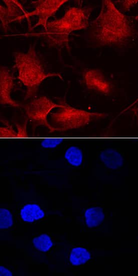 Smad9 antibody in A172 Human Cell Line by Immunocytochemistry (ICC).