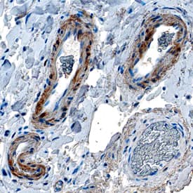 Smoothelin B antibody in Human Colon by Immunohistochemistry (IHC-P).