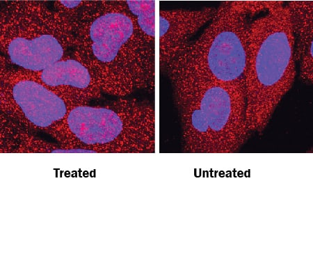 Snail antibody in A549 Human Cell Line by Immunocytochemistry (ICC).
