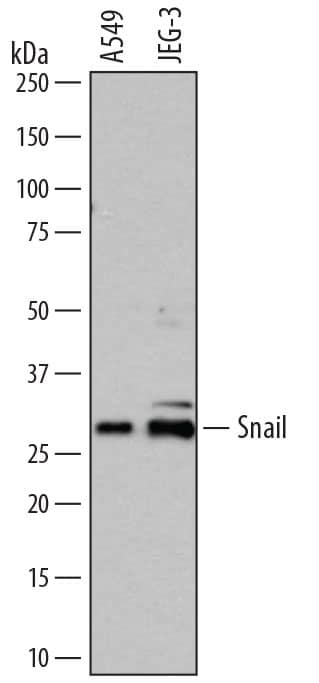 Detection of Human Snail antibody by Western Blot.