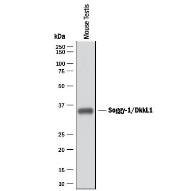 Detection of Mouse Soggy-1/DkkL1 antibody by Western Blot.